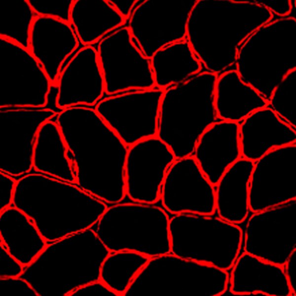 Fluorescent microscope image of a cross section of mouse tibialis anterior muscle labeled with DSHB antibody MANDRA(7A10). PMID: 33200567, Fig. 2F.